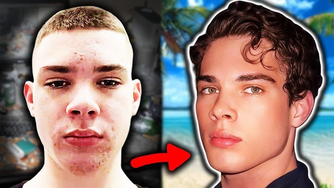 Transformation Bild
